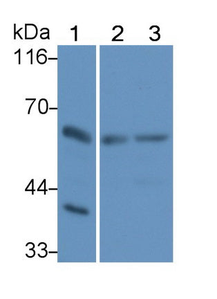 Receptor Interacting Serine Threonine Kinase 2 (RIPK2) Polyclonal Antibody - image 2