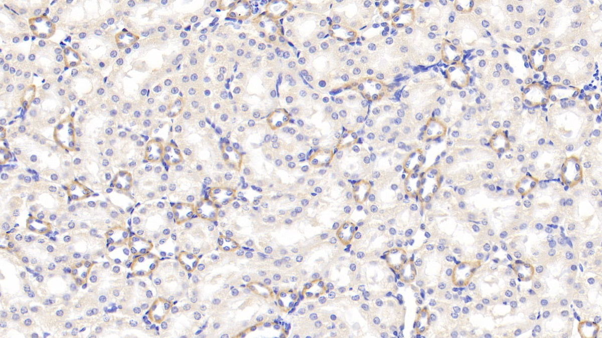 DAB staining on fromalin fixed paraffin- embedded kidney tissue)