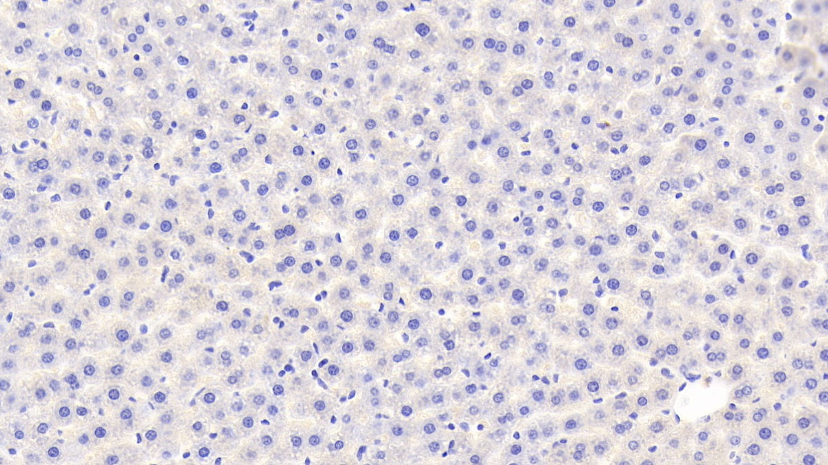 Receptor Interacting Serine Threonine Kinase 2 (RIPK2) Polyclonal Antibody - image 4