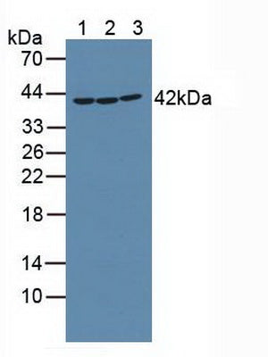 Knockout Varification: ; Lane 1: Wild-type K562 cell lysate; ; Lane 2: RIPK2 knockout K562 cell lysate; ; Predicted MW: 61,46kd ; Observed MW: 44kd; Primary Ab: 1µg/ml Rabbit Anti-Human RIPK2 Antibody; Second Ab: 0.2µg/mL HRP-Linked Caprine Anti-Rabbit IgG Polyclonal Antibody;