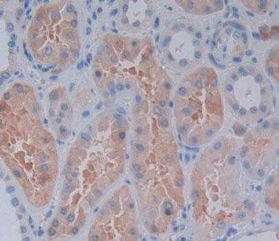 Receptor Interacting Serine Threonine Kinase 2 (RIPK2) Polyclonal Antibody - image 4