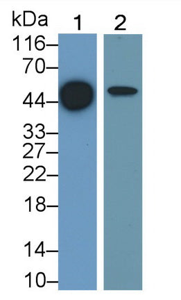 Orosomucoid 2 (ORM2) Polyclonal Antibody - image 3