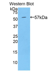 Transglutaminase 1 (TGM1) Polyclonal Antibody - image 2