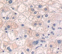Transglutaminase 1 (TGM1) Polyclonal Antibody - image 3