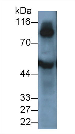 Transglutaminase 1 (TGM1) Polyclonal Antibody - image 2