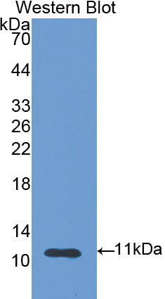 S100 Calcium Binding Protein A6 (S100A6) Polyclonal Antibody - image 2