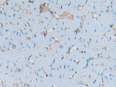 DAB staining on fromalin fixed paraffin-embedded lung tissue)