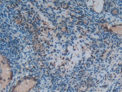 S100 Calcium Binding Protein A6 (S100A6) Polyclonal Antibody - image 4