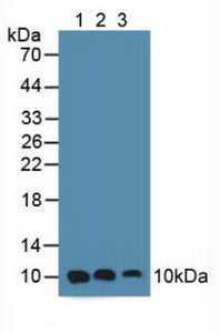 Knockout Varification: <br/>Lane 1: Wild-type Hela cell lysate; <br/>Lane 2: S100A6 knockout Hela cell lysate; <br/>Predicted MW: 10kDa <br/>Observed MW: 10kDa<br/>Primary Ab: 4µg/ml Rabbit Anti-Human S100A6 Antibody<br/>Second Ab: 0.2µg/mL HRP-Linked Caprine Anti-Rabbit IgG Polyclonal Antibody<br/>