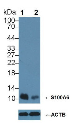 FITC staining on IF; Samples: Human MCF7 cell;  Primary Ab: 20μg/ml Rabbit Anti-Human S100A6 Antibody Second Ab: 1.5μg/ml FITC-Linked Caprine Anti-Rabbit IgG Polyclonal Antibody