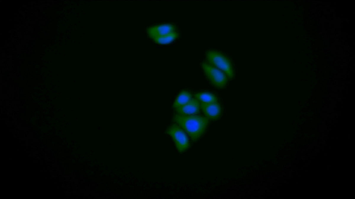 S100 Calcium Binding Protein A6 (S100A6) Polyclonal Antibody - image 4