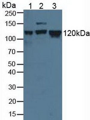 Knockout Varification: ; Lane 1: Wild-type K562 cell lysate; ; Lane 2: MCM2 knockout K562 cell lysate; ; Predicted MW: 101kd ; Observed MW: 120kd; Primary Ab: 3µg/ml Rabbit Anti-Human MCM2 Antibody; Second Ab: 0.2µg/mL HRP-Linked Caprine Anti-Rabbit IgG Polyclonal Antibody;