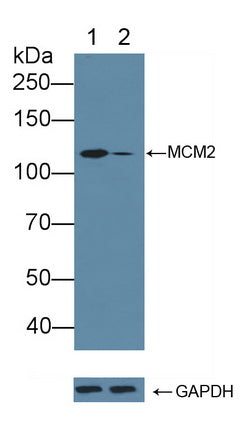 Figure. FITC staining on IHC-P; Samples: Human Hela Cells.