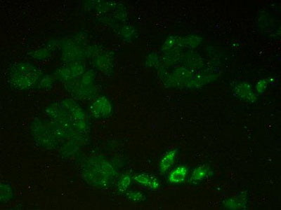 Minichromosome Maintenance Deficient 2 (MCM2) Polyclonal Antibody - image 4