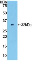 Oncostatin M Receptor (OSMR) Polyclonal Antibody - image 2