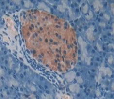 Regenerating Islet Derived Protein 1 Alpha (REG1a) Polyclonal Antibody - image 4