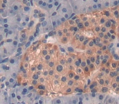 Regenerating Islet Derived Protein 1 Alpha (REG1a) Polyclonal Antibody - image 3