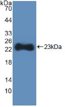 DAB staining on IHC-P; Samples: Human Liver Tissue; Primary Ab: 10µg/ml Rabbit Anti-Human HMGCS Antibody Second Ab: 2µg/mL HRP-Linked Caprine Anti-Rabbit IgG Polyclonal Antibody