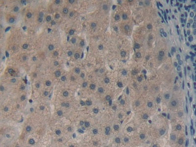 DAB staining on IHC-P; Samples: Human Kidney Tissue.