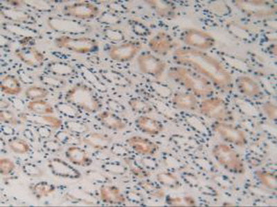Hydroxymethylglutaryl Coenzyme A Synthase (HMGCS) Polyclonal Antibody - image 5