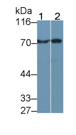 Transglutaminase 3, Epidermal (TGM3) Polyclonal Antibody - image 2