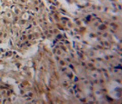 Transglutaminase 3, Epidermal (TGM3) Polyclonal Antibody - image 3