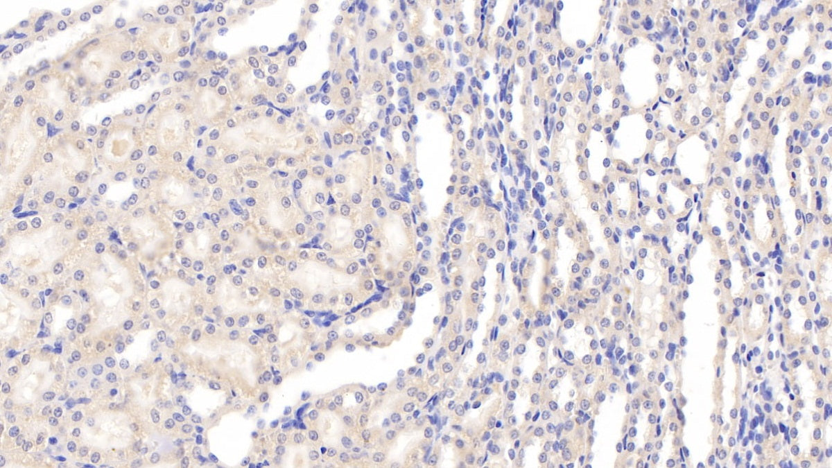 Tumor Necrosis Factor Ligand Superfamily, Member 13 (TNFSF13) Polyclonal Antibody - image 4