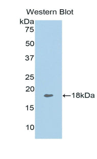 DAB staining on IHC-P; Samples: Human Spleen Tissue; Primary Ab: 20μg/ml Rabbit Anti-Human TNFSF13 Antibody Second Ab: 2µg/mL HRP-Linked Caprine Anti-Rabbit IgG Polyclonal Antibody