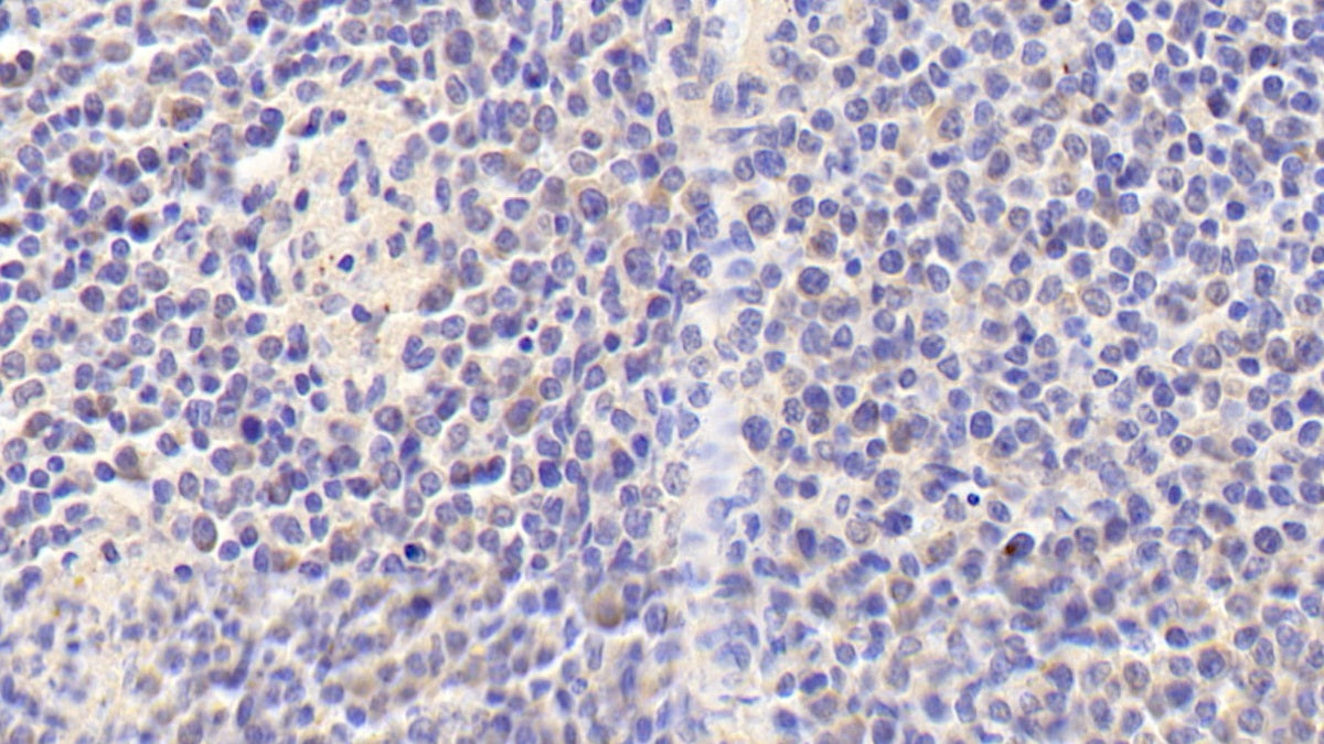 DAB staining on IHC-P. Samples: Human Tissue)