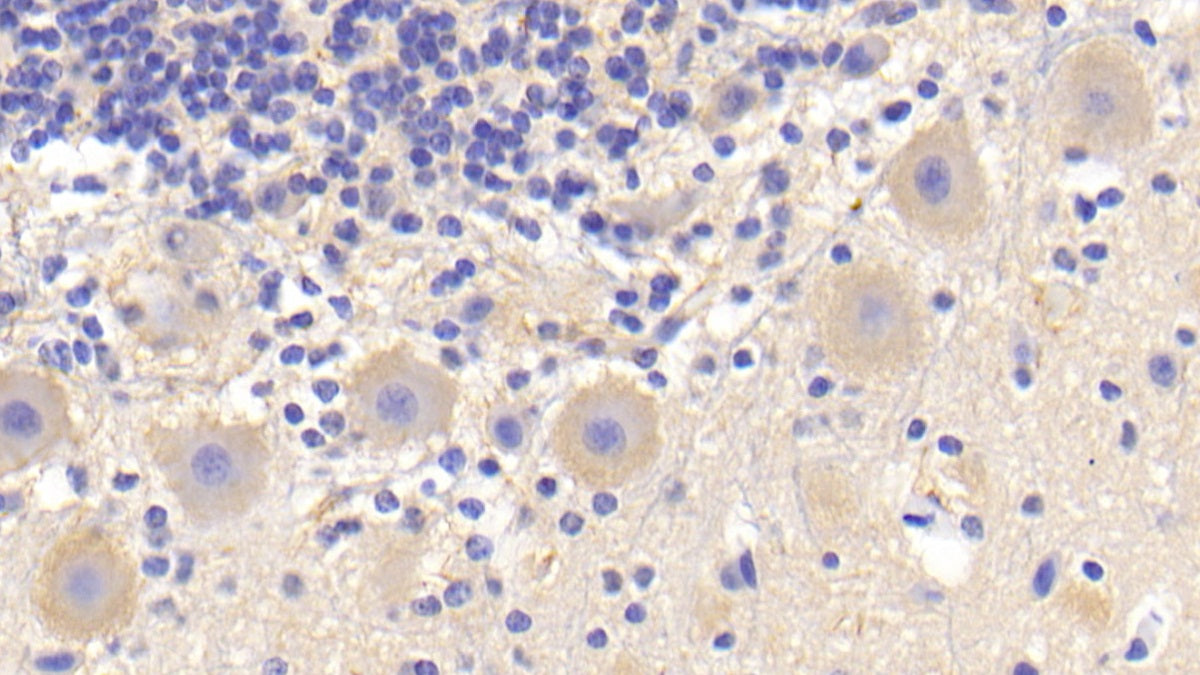 Tumor Necrosis Factor Ligand Superfamily, Member 13 (TNFSF13) Polyclonal Antibody - image 5