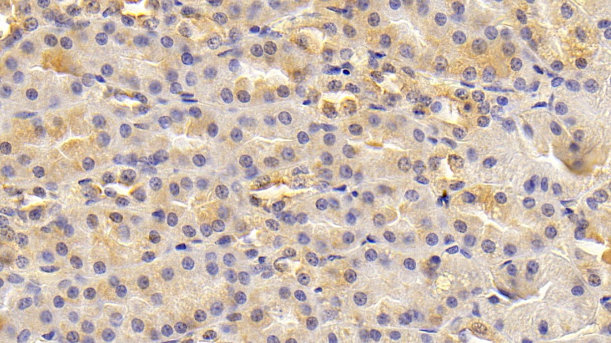 Tumor Necrosis Factor Ligand Superfamily, Member 13 (TNFSF13) Polyclonal Antibody - image 3