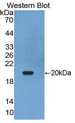 DAB staining on IHC-P; Samples: Bovine Kidney Tissue; Primary Ab: 20μg/ml Rabbit Anti-Bovine TNFSF13 Antibody Second Ab: 2µg/mL HRP-Linked Caprine Anti-Rabbit IgG Polyclonal Antibody