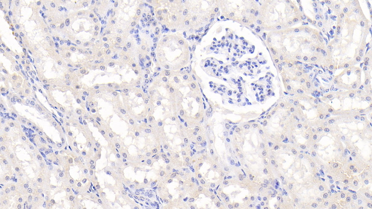 DAB staining on IHC-P; Samples: Bovine Cardiac Muscle Tissue;  Primary Ab: 20μg/ml Rabbit Anti-Bovine TNFSF13 Antibody Second Ab: 2µg/mL HRP-Linked Caprine Anti-Rabbit IgG Polyclonal Antibody