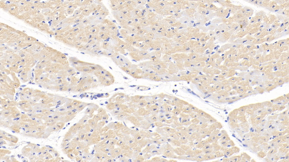 Tumor Necrosis Factor Ligand Superfamily, Member 13 (TNFSF13) Polyclonal Antibody - image 5