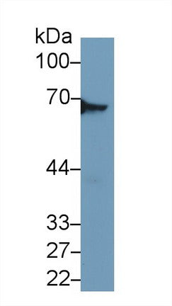 Western Blot; Sample: Recombinant protein.