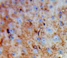 Dihydropyrimidinase Like Protein 3 (DPYSL3) Polyclonal Antibody - image 4
