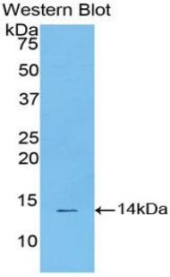 Signal Transducer And Activator Of Transcription 3 (STAT3) Polyclonal Antibody - image 2