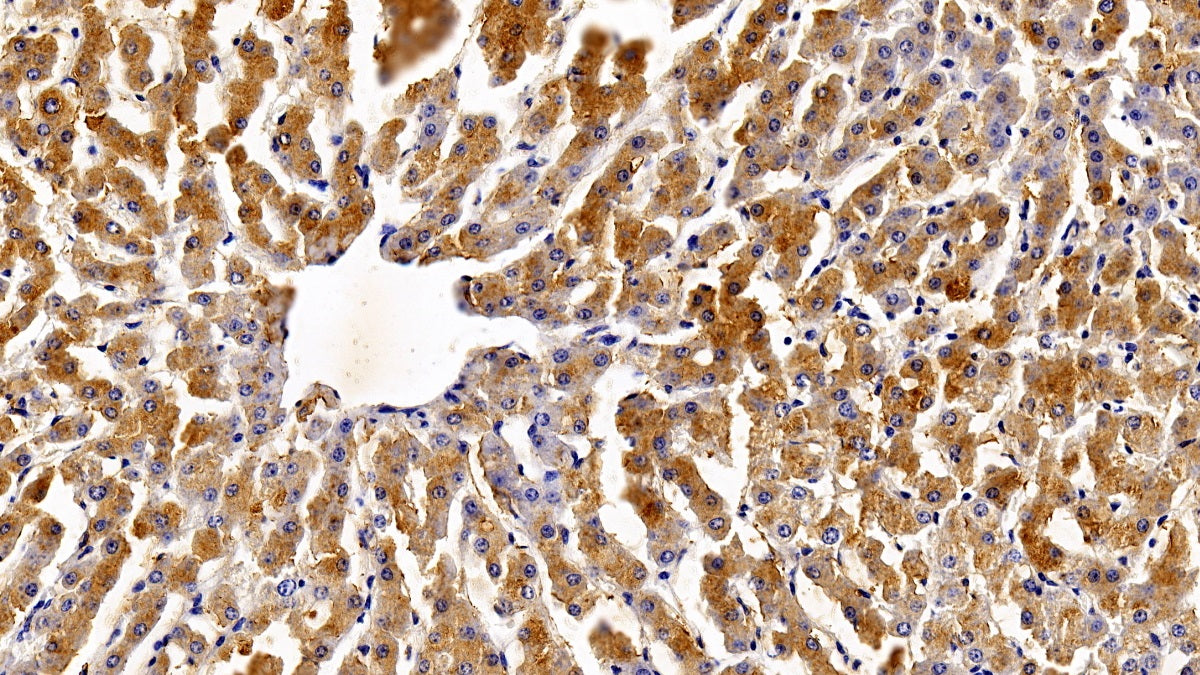 Signal Transducer And Activator Of Transcription 3 (STAT3) Polyclonal Antibody - image 3
