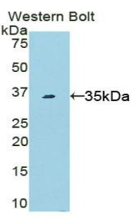 Signal Transducer And Activator Of Transcription 6 (STAT6) Polyclonal Antibody - image 2