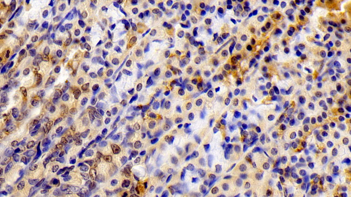 Signal Transducer And Activator Of Transcription 6 (STAT6) Polyclonal Antibody - image 4