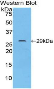 Signal Transducer And Activator Of Transcription 6 (STAT6) Polyclonal Antibody - image 2