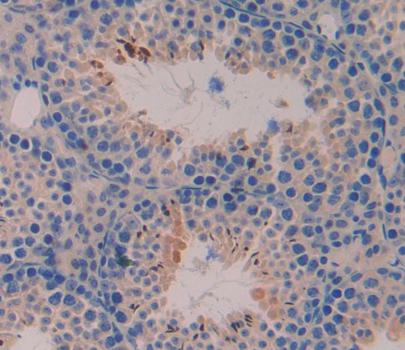 Signal Transducer And Activator Of Transcription 6 (STAT6) Polyclonal Antibody - image 3