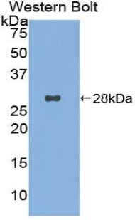 Used in DAB staining on fromalin fixed paraffin-embedded Liver tissue