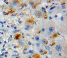 C-Type Lectin Domain Family 13, Member A (CLEC13A) Polyclonal Antibody - image 4