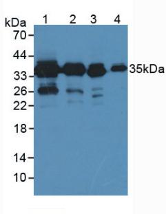 Western Blot; Sample: Recombinant PDXK, Mouse.