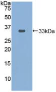 DAB staining on IHC-P; Samples: Mouse Kidney Tissue; Primary Ab: 10µg/ml Rabbit Anti-Mouse PDXK Antibody Second Ab: 2µg/mL HRP-Linked Caprine Anti-Rabbit IgG Polyclonal Antibody