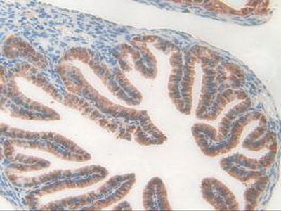 Pyridoxal Kinase (PDXK) Polyclonal Antibody - image 5