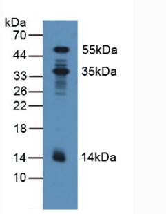 Western Blot; Sample: Recombinant PDXK, Human.