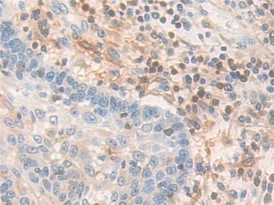 DAB staining on IHC-P; Samples: Human Kidney Tissue.