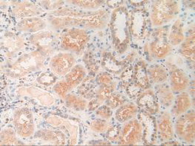 Pyridoxal Kinase (PDXK) Polyclonal Antibody - image 5